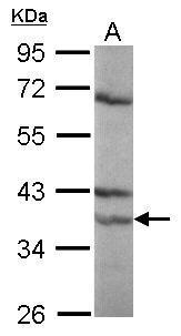 Retinoic Acid Receptor alpha Antibody