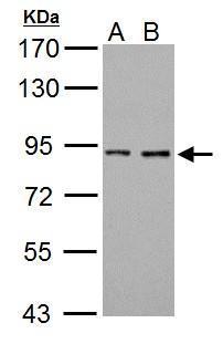 Prothrombin Antibody