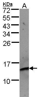 beta 2 Microglobulin Antibody
