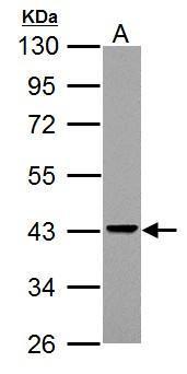 Adenosine Deaminase Antibody