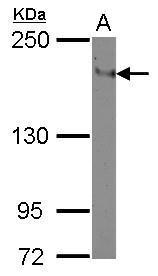 CD11a Antibody