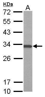 ATP6V1E1 Antibody