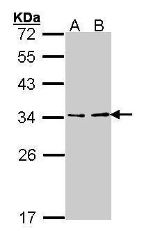 ATP6V1E1 Antibody