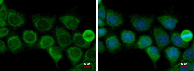 ACAT1 Antibody