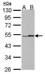 Retinoic Acid Receptor gamma Antibody