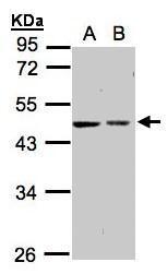 GALK2 Antibody