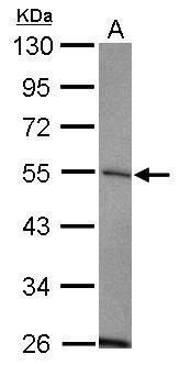 USP14 Antibody