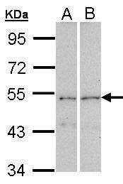 CPEB1 Antibody