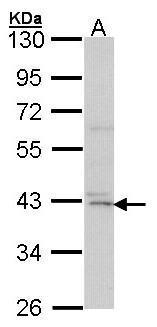 DAP Kinase 2 Antibody