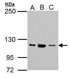 NSUN1 Antibody