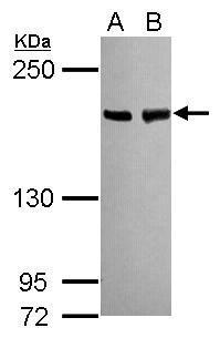 BLM Antibody