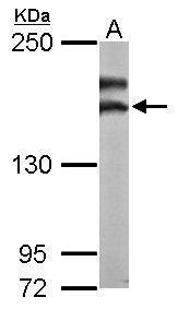 NMDAR2B Antibody