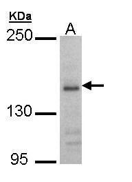 NMDAR2B Antibody