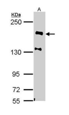 NF-H  Antibody
