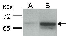 Estrogen Receptor beta Antibody