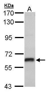Estrogen Receptor beta Antibody
