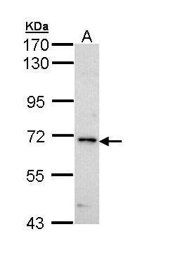 IRAK Antibody