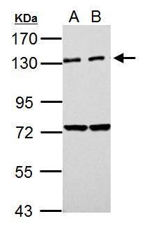 PKN2 Antibody