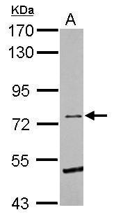 Eph Receptor B6 Antibody