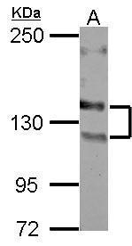NCAM Antibody