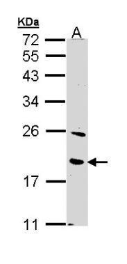 BNIP3 Antibody