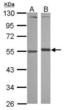 Alpha 1 antitrypsin Antibody