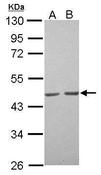 alpha Actin (skeletal muscle) Antibody
