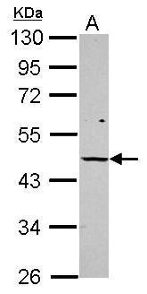Vitamin D Receptor Antibody