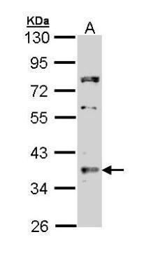 TRADD Antibody