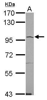 ACE2 Antibody