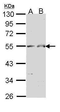 Chromogranin A Antibody