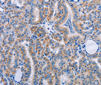FN1 Antibody