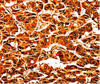 UPK3B Antibody