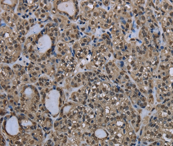 UBB Antibody