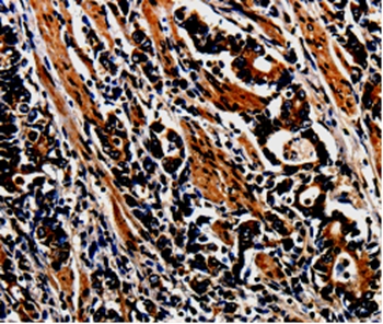 MAGEA4 Antibody