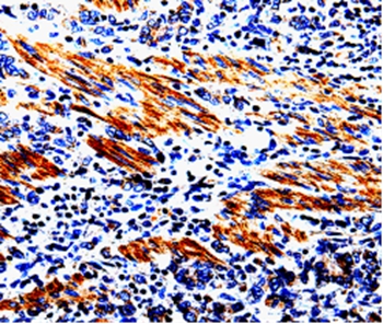 ACSBG2 Antibody