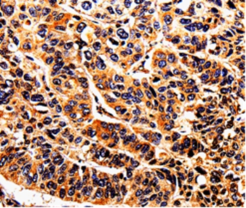 DAZ4 Antibody
