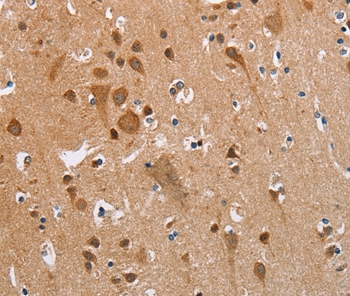KRT13 Antibody