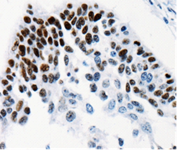 TGIF2LX Antibody