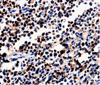 ALOX5 Antibody