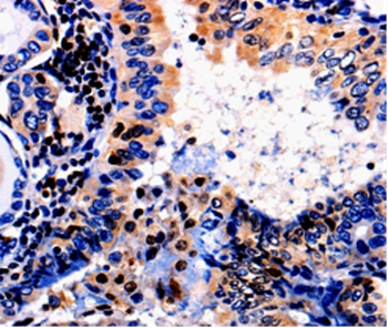 ALOX5 Antibody