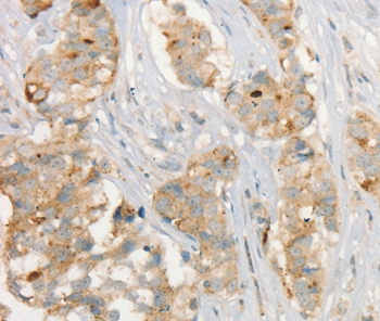 MMP9 Antibody