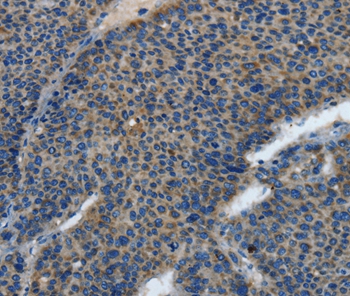 TLR4 Antibody