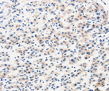 AIMP2 Antibody