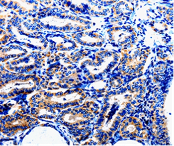 NFKB1p105 Antibody