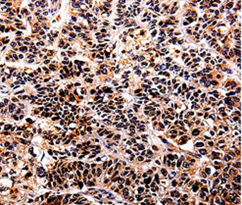 IL10RA Antibody