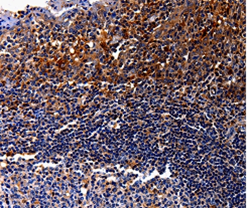 IL10RA Antibody