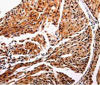 IL10RB Antibody