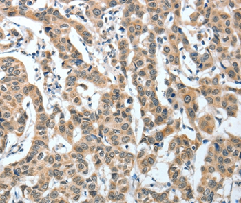 IL1R1 Antibody