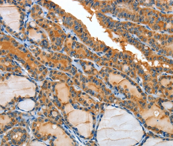 IL1R1 Antibody